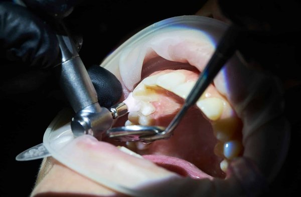 Les cliniques dentaires à Laval offrent-elles des traitements pour les seniors ?